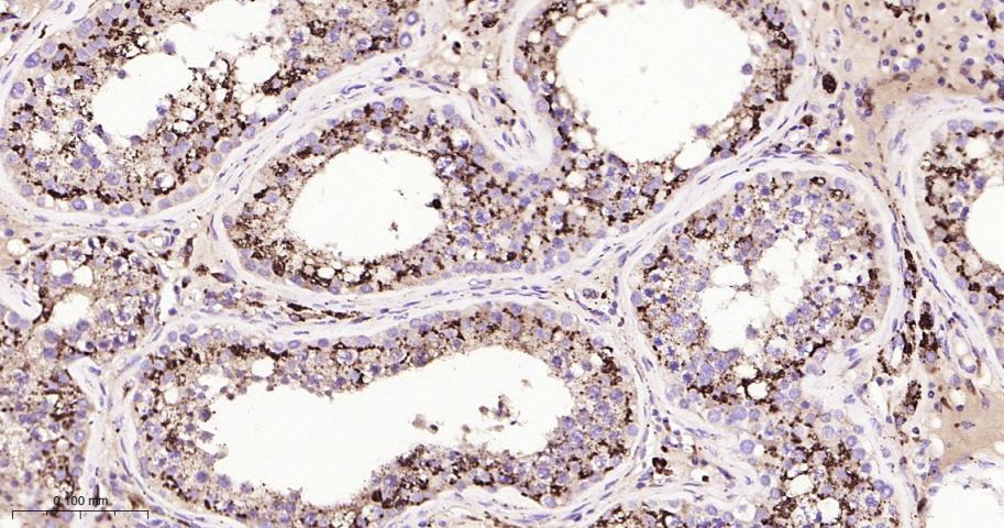 组织蛋白酶D重组兔单抗