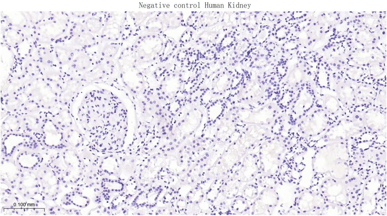 黑色素瘤相关抗原gp100重组兔单抗
