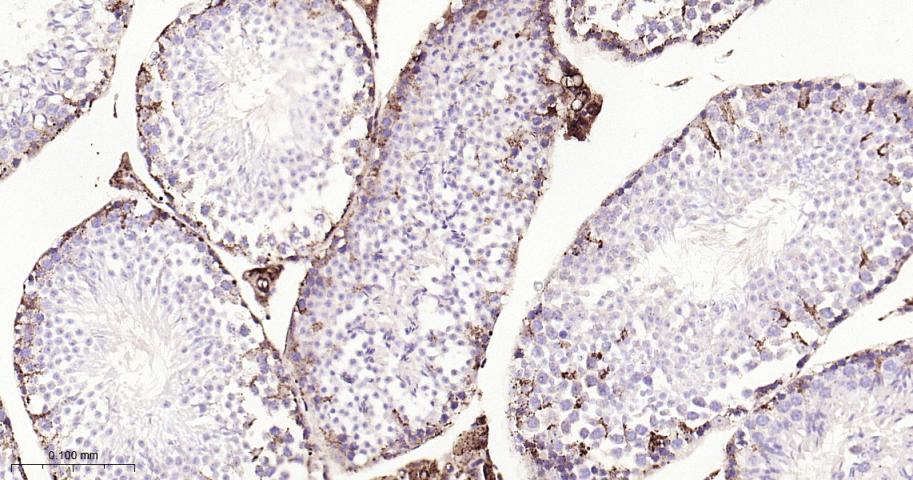 组织蛋白酶D重组兔单抗