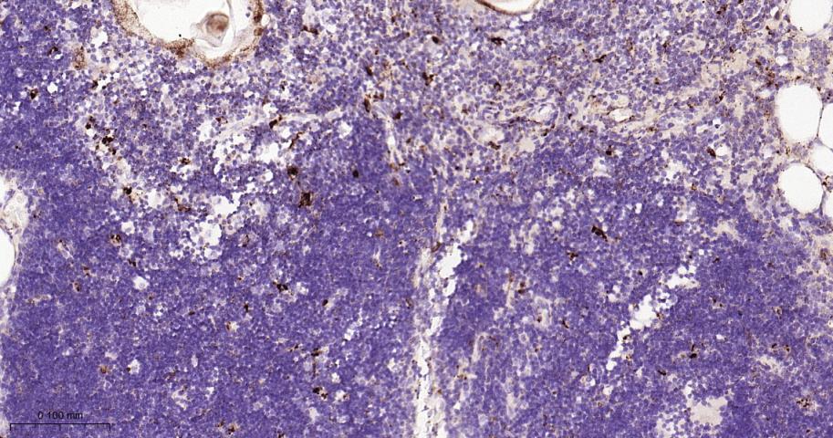 组织蛋白酶D重组兔单抗