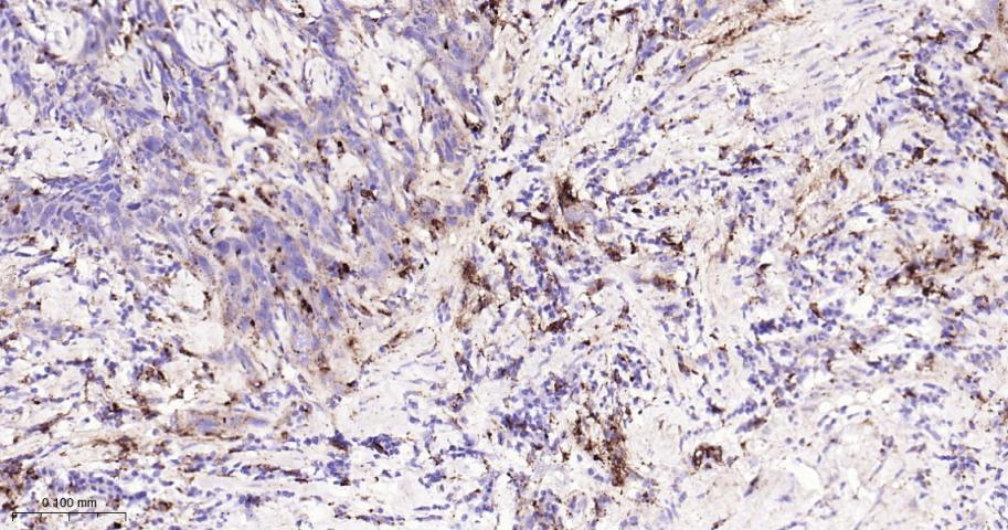 组织蛋白酶D重组兔单抗