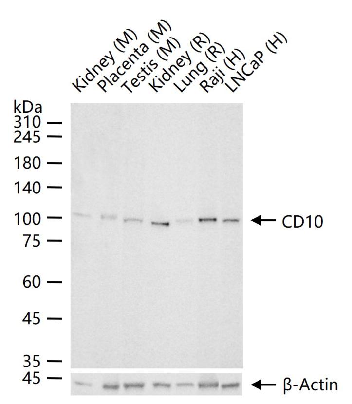 CD10重组兔单抗