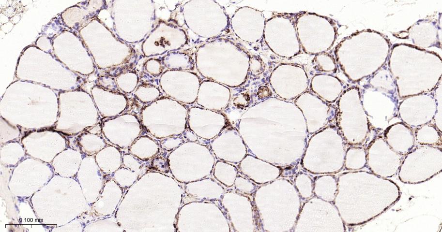 组织蛋白酶D重组兔单抗