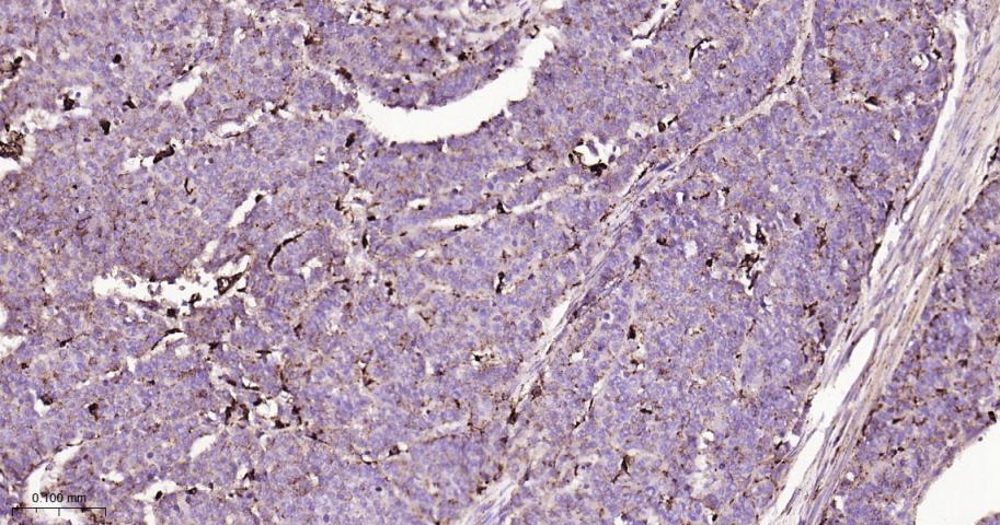 组织蛋白酶D重组兔单抗