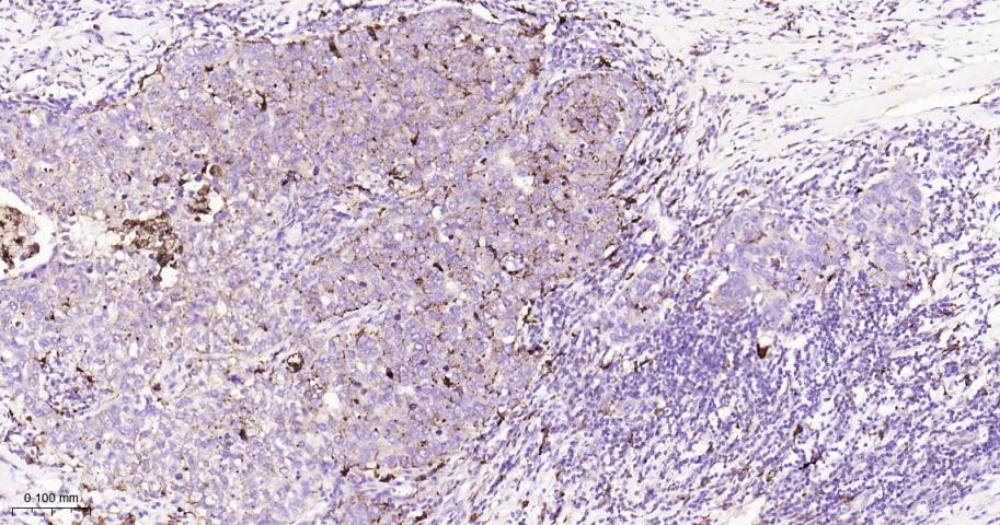 组织蛋白酶D重组兔单抗
