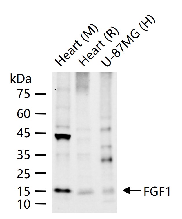 酸性成纤维细胞生长因子重组兔单抗