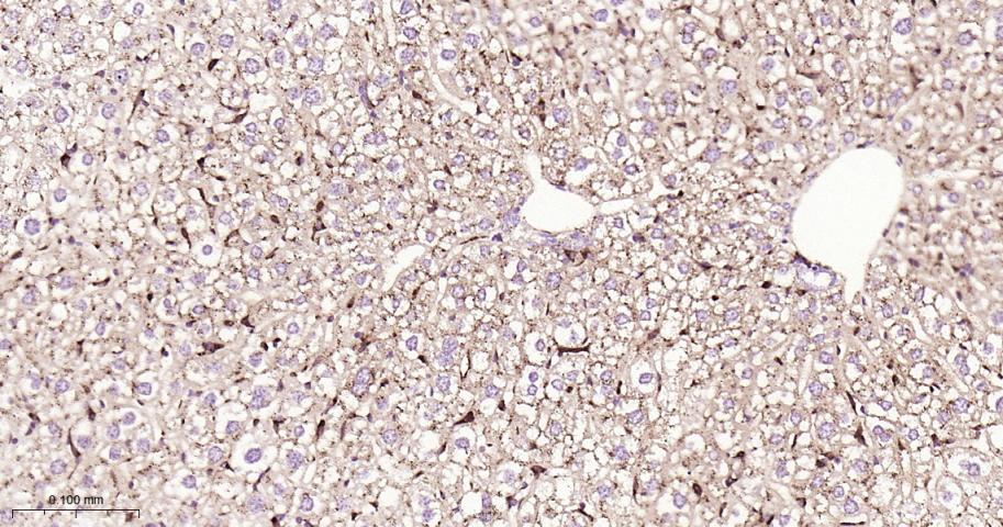 组织蛋白酶D重组兔单抗