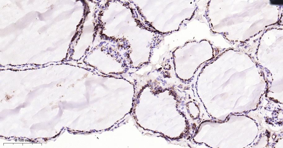 组织蛋白酶D重组兔单抗