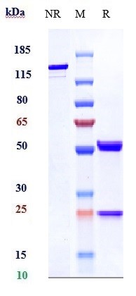 Anti-human VEGF (Bevacizumab Biosimilar) (Biosimilar抗体) | Bioss