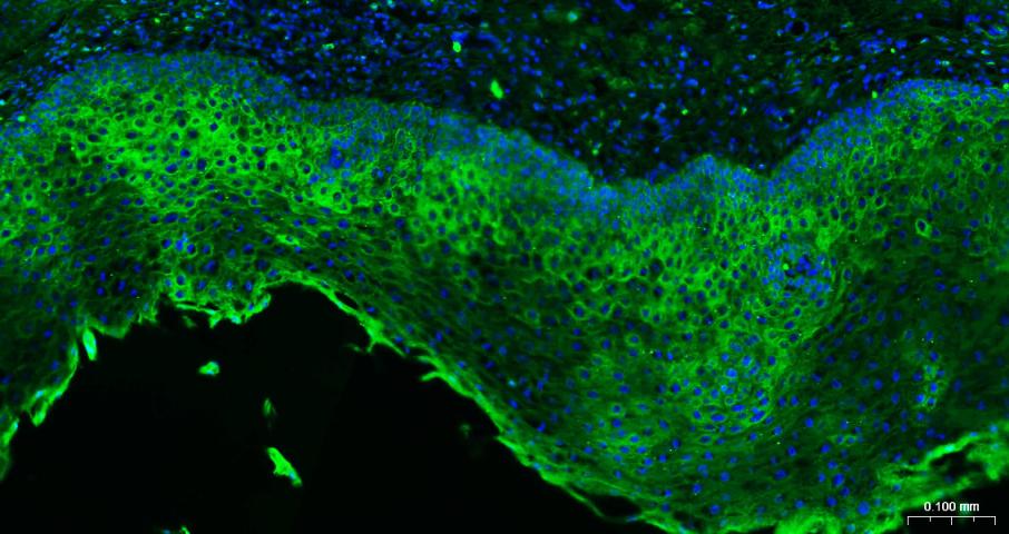 细胞角蛋白17单克隆抗体-bsm-33087M