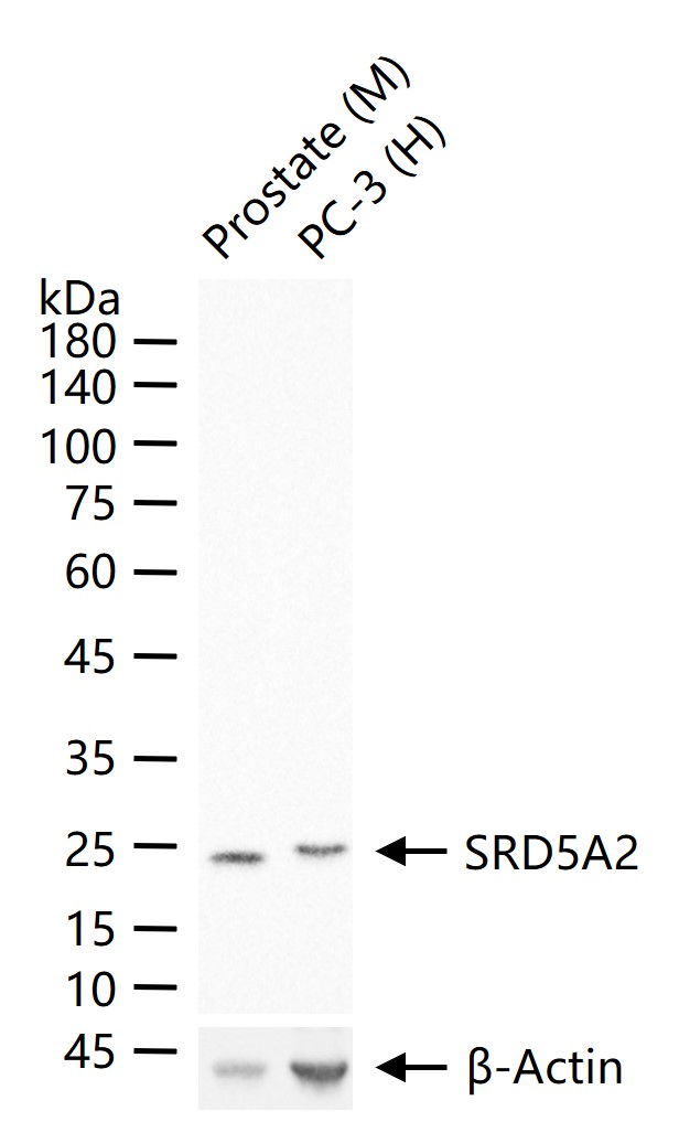 类固醇5α还原酶2重组兔单抗