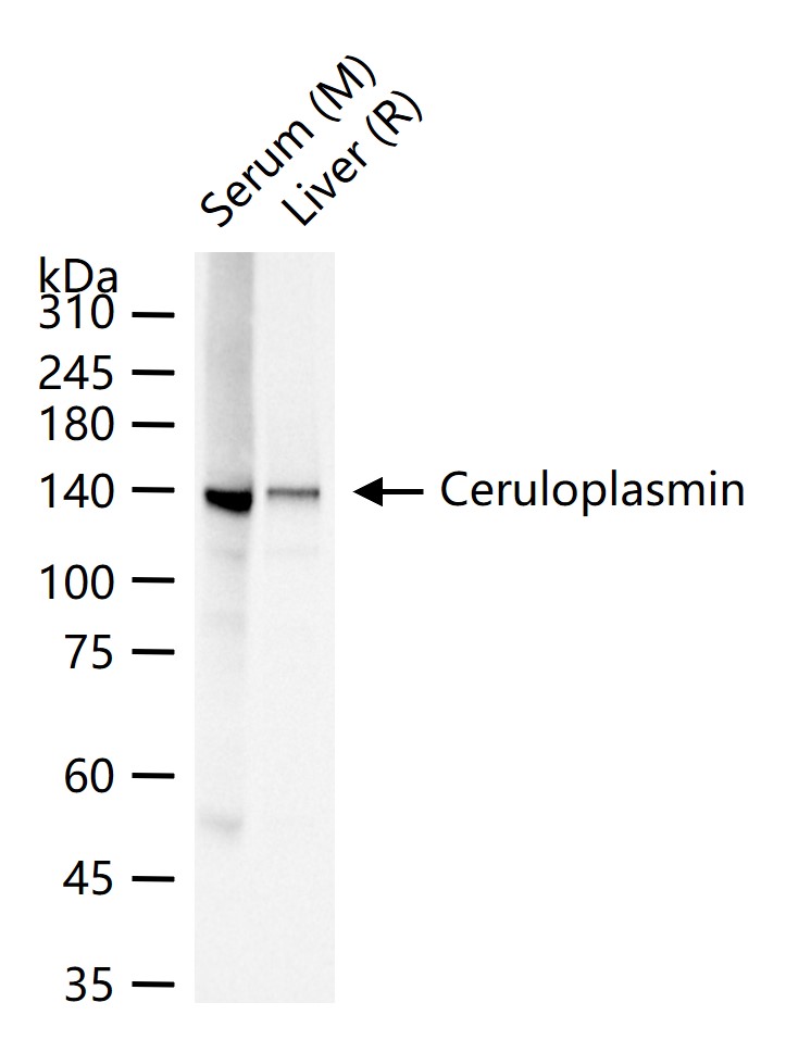 铜蓝蛋白重组兔单抗-bsm-62822R