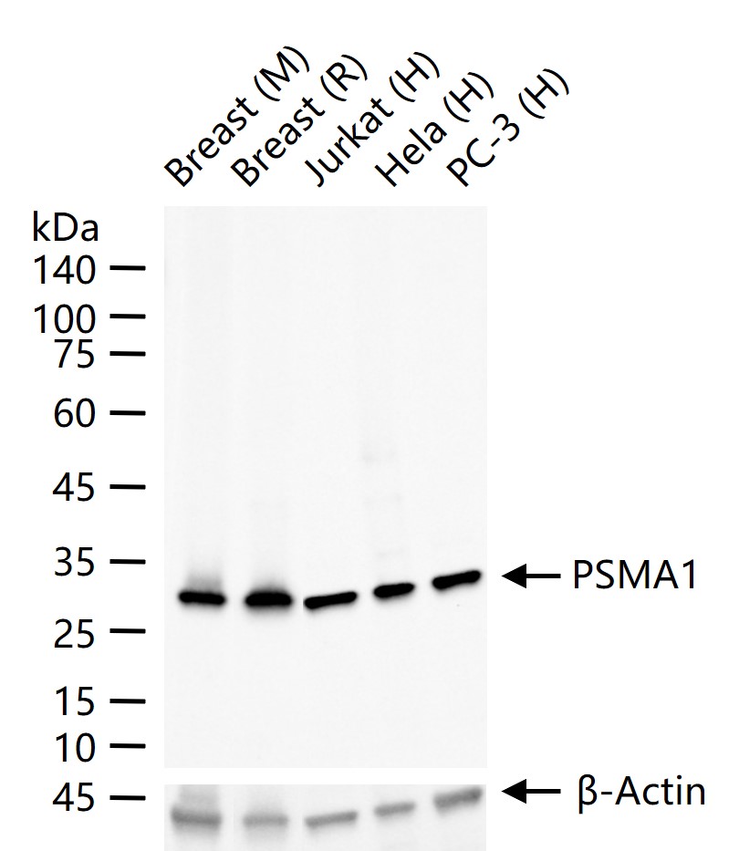 PSMA1 Recombinant Rabbit mAb (一抗) - WB,IHC-P,IHC-F,IF,Flow-Cyt,ICC/IF | Bioss