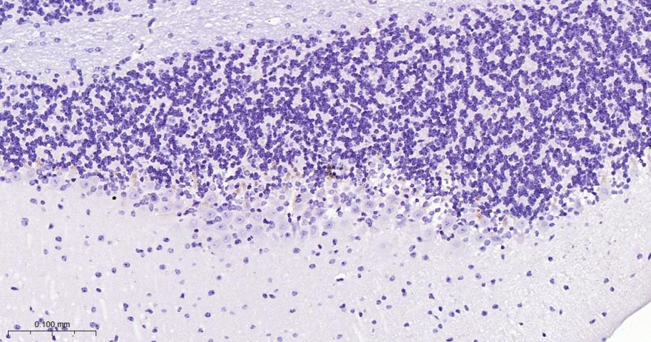 突触后密度蛋白95重组兔单抗