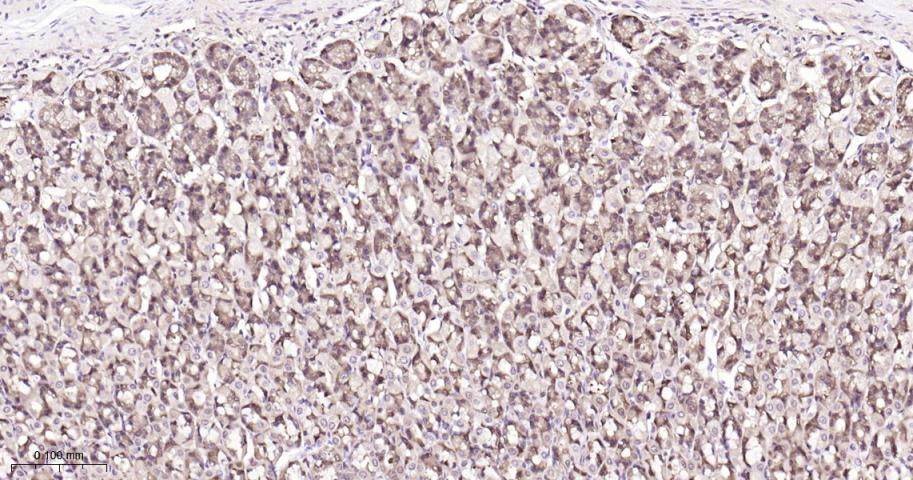 谷胱甘肽硫转移酶pi重组兔单抗