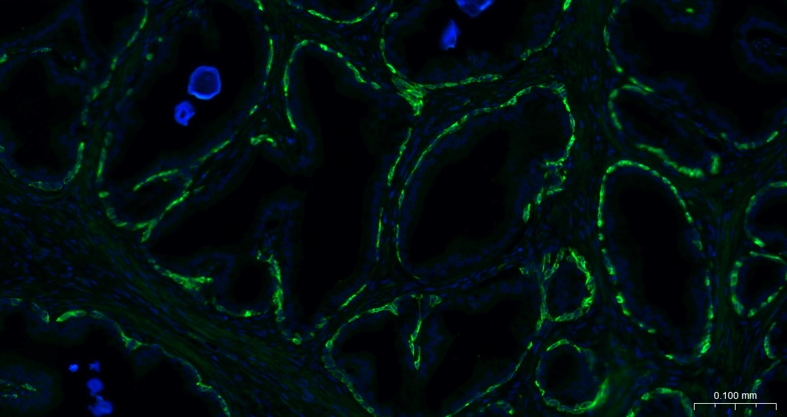 细胞角蛋白14重组兔单抗