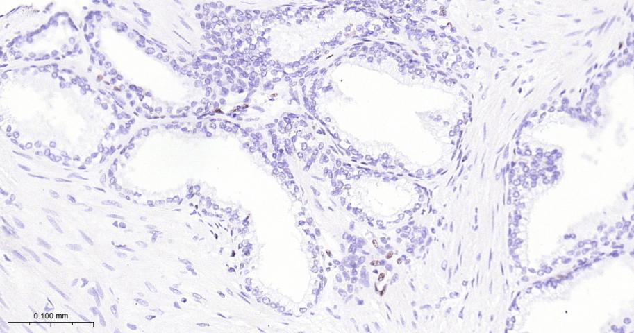 癌基因ERG重组兔单抗