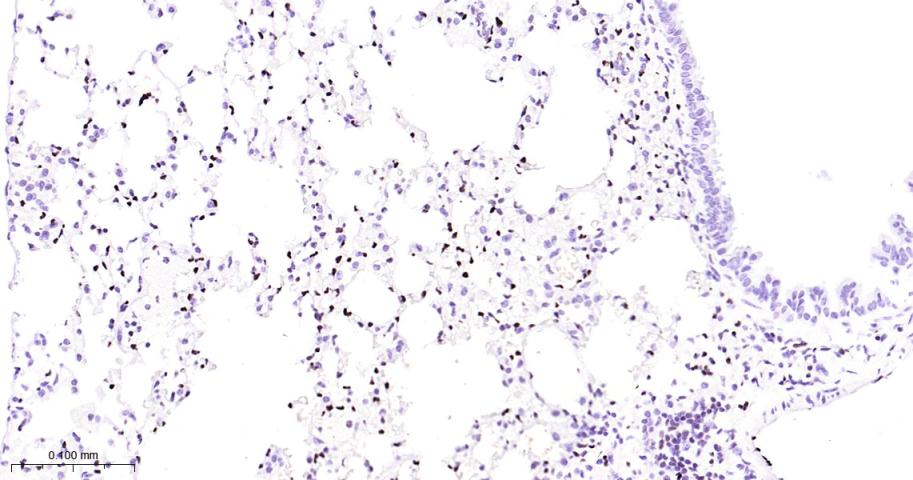 癌基因ERG重组兔单抗