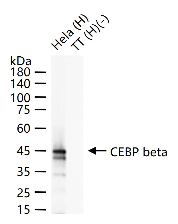 转录调节因子CEBP β重组兔单抗