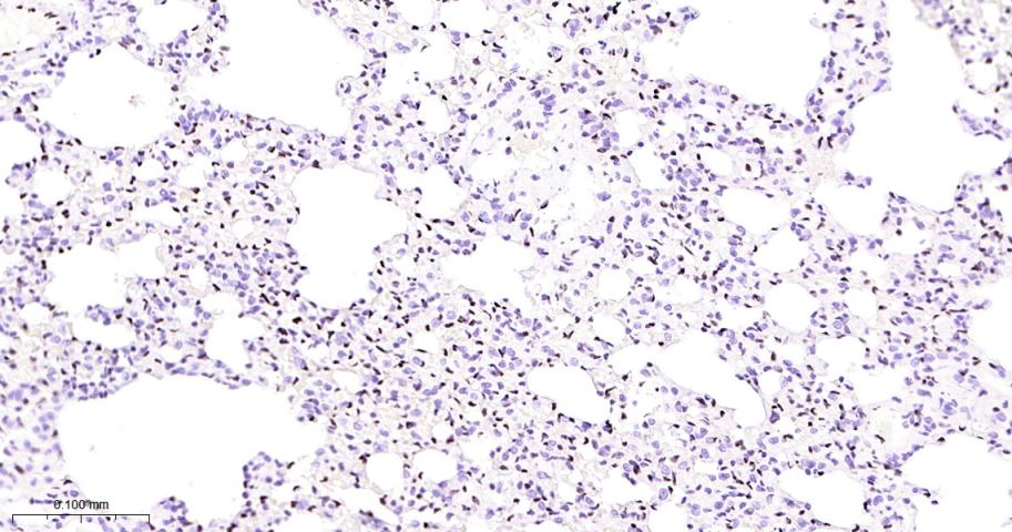 癌基因ERG重组兔单抗
