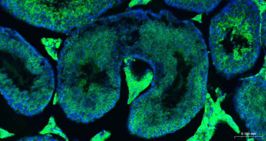 真核翻译起始因子4E重组兔单抗