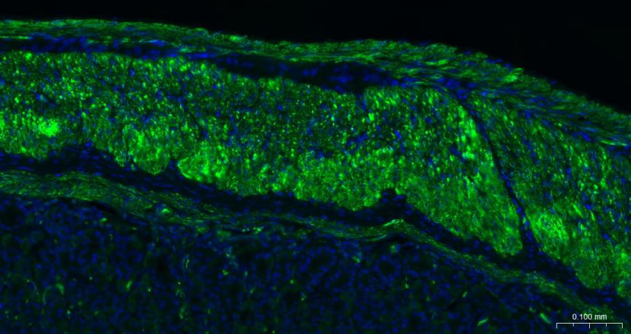 α-SMA重组兔单抗