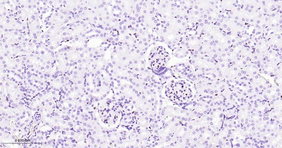 癌基因ERG重组兔单抗