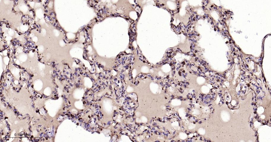 谷胱甘肽硫转移酶pi重组兔单抗