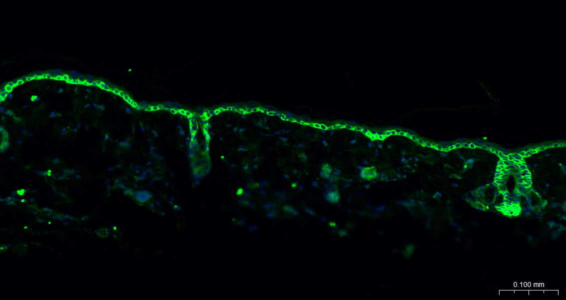 细胞角蛋白15重组兔单抗