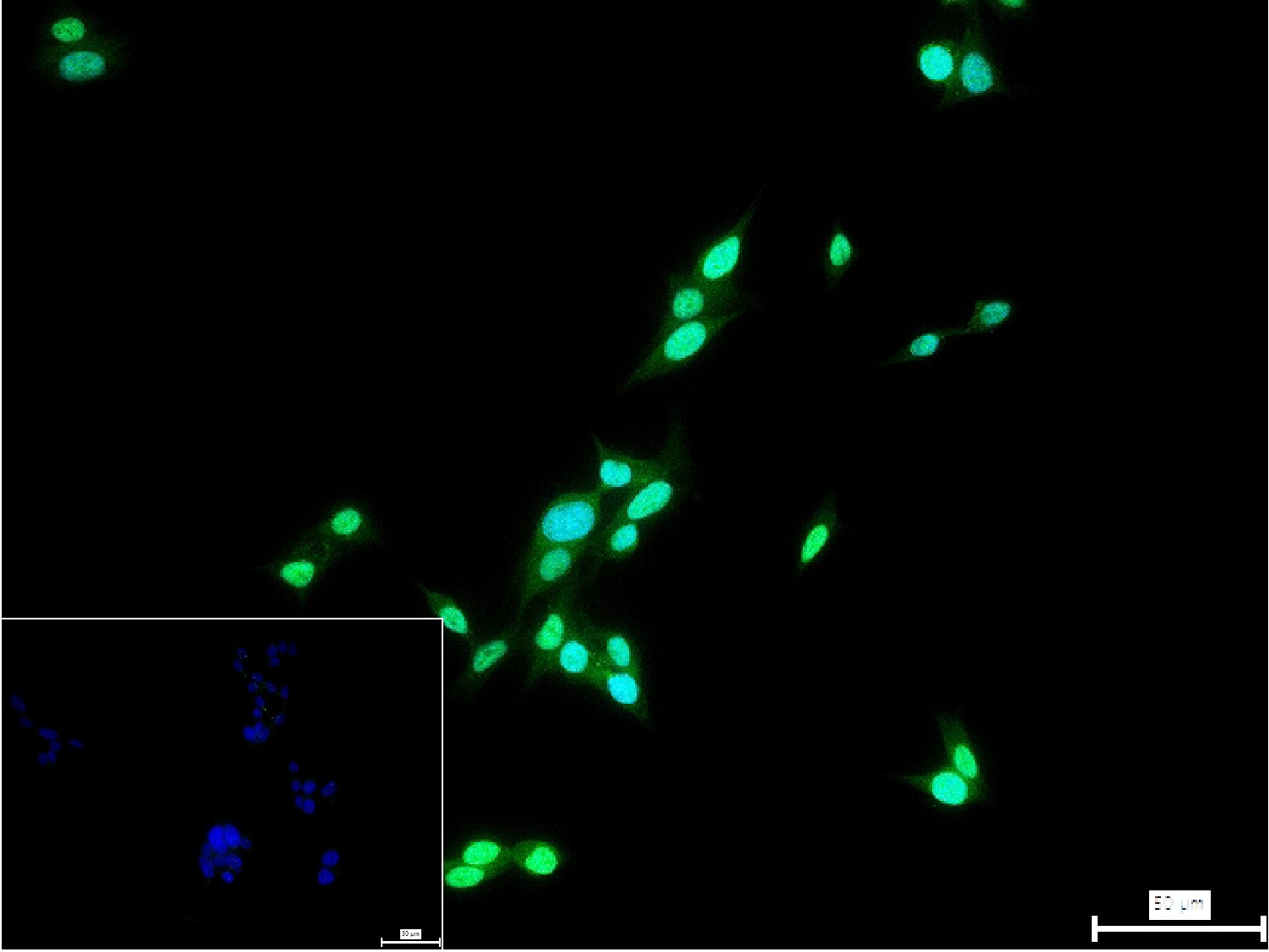甲状腺核转录因子-1重组兔单抗