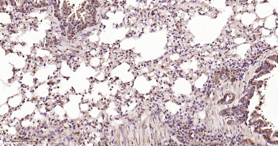谷胱甘肽硫转移酶pi重组兔单抗