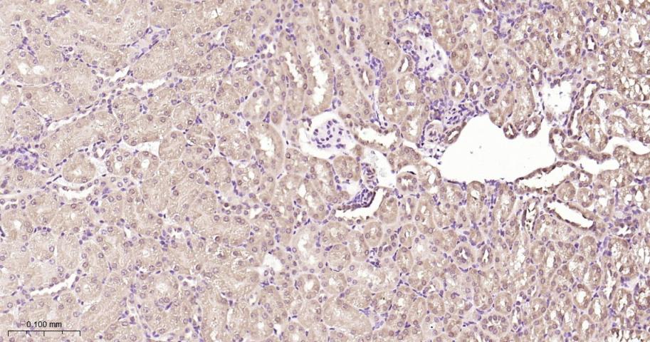 谷胱甘肽硫转移酶pi重组兔单抗