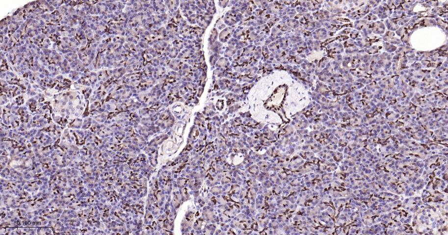 谷胱甘肽硫转移酶pi重组兔单抗