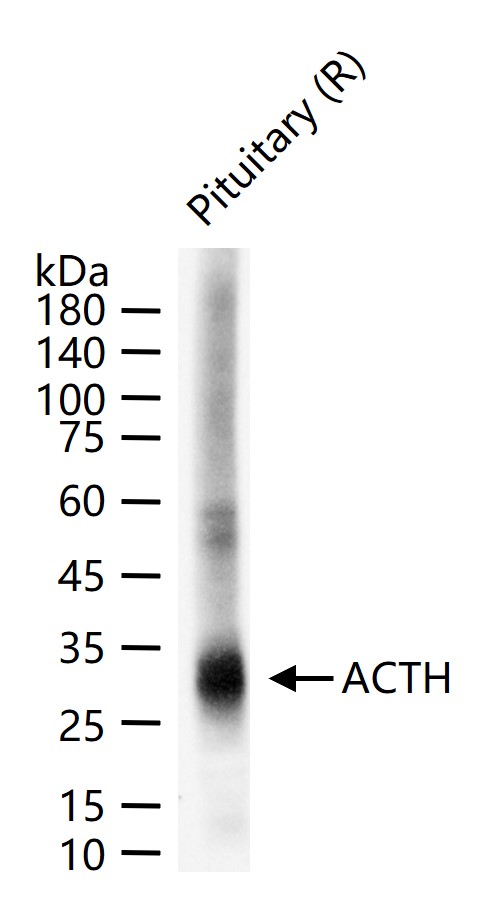 促肾上腺皮质激素重组兔单克隆抗体