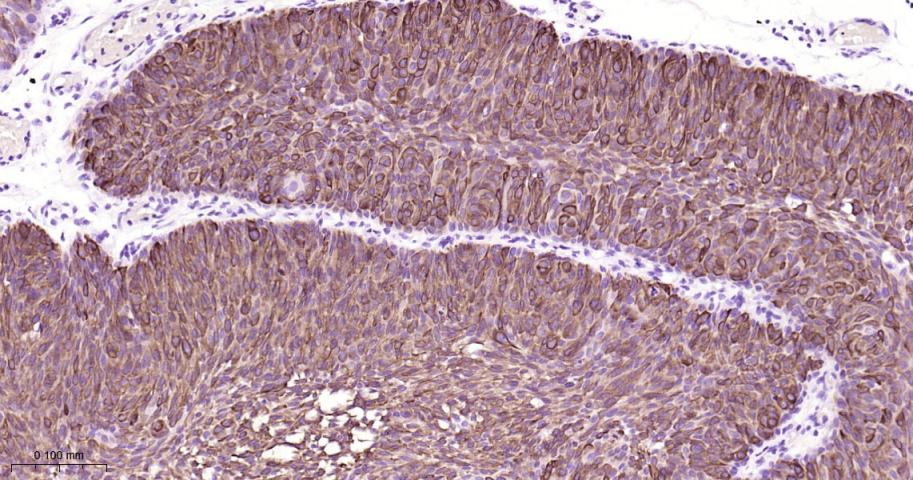 细胞角蛋白13重组兔单抗