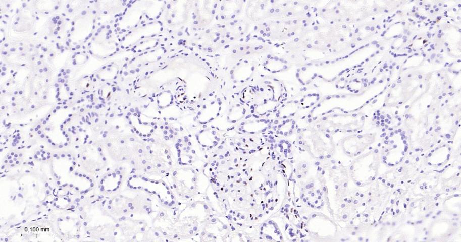 癌基因ERG重组兔单抗