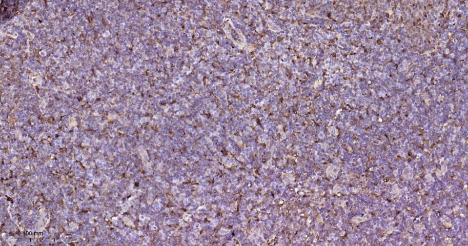 谷胱甘肽硫转移酶pi重组兔单抗