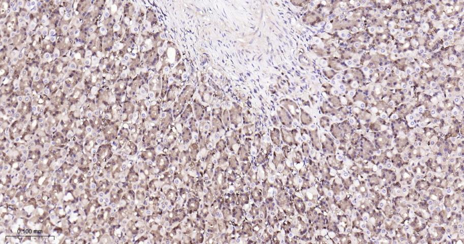 谷胱甘肽硫转移酶pi重组兔单抗