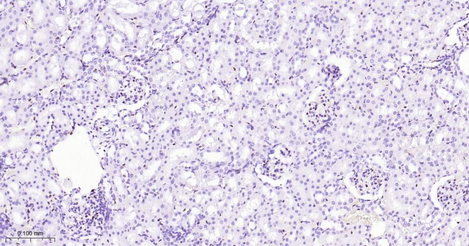 癌基因ERG重组兔单抗