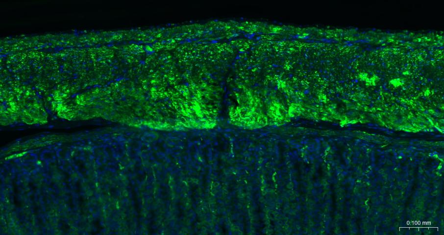 α-SMA重组兔单抗