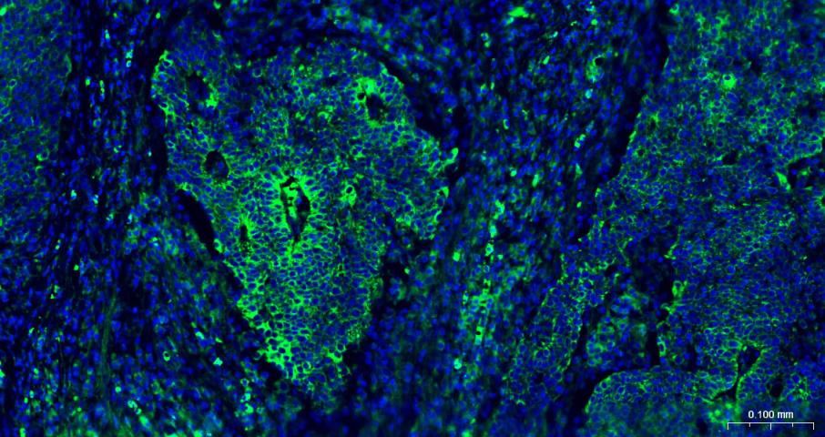 细胞角蛋白15重组兔单抗