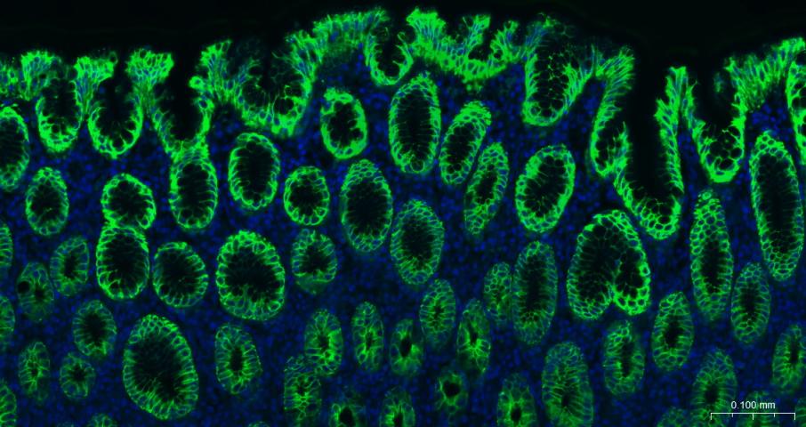 细胞角蛋白8重组兔单抗
