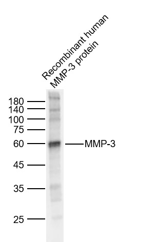 基质金属蛋白酶3抗体-bs-0413R