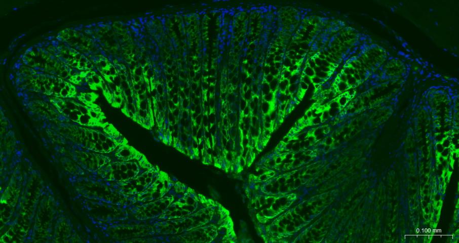 细胞角蛋白8重组兔单抗