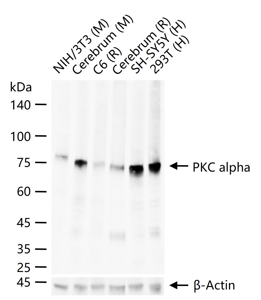 蛋白激酶C α重组兔单抗