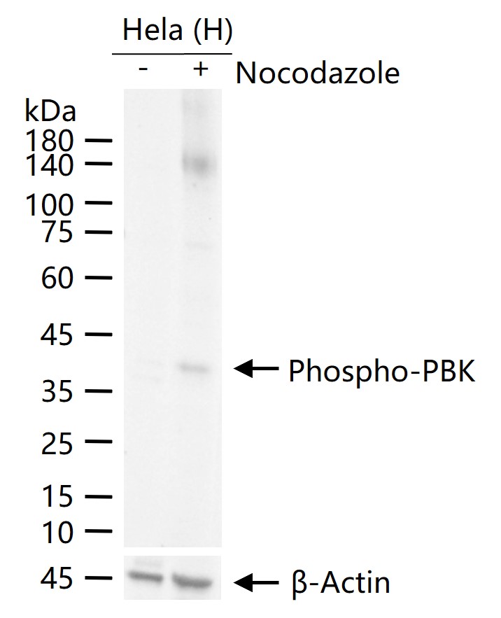磷酸化PDZ连接激酶/T-LAK细胞源蛋白激酶重组兔单抗-bsm-62741R