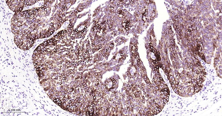 细胞角蛋白13重组兔单抗