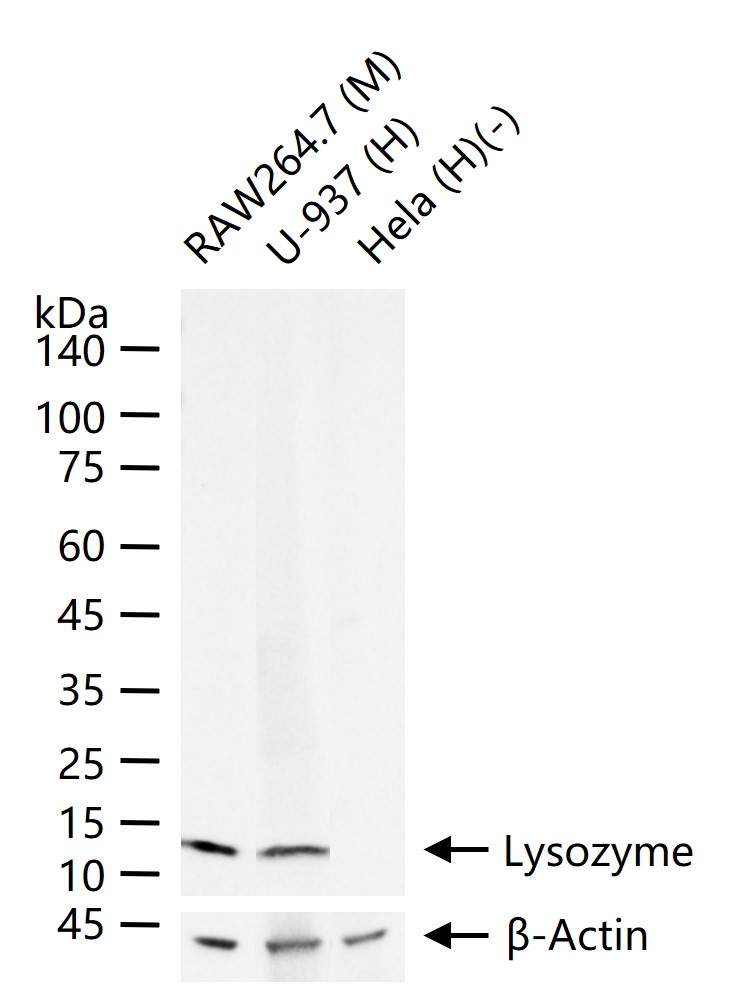 溶菌酶重组兔单抗