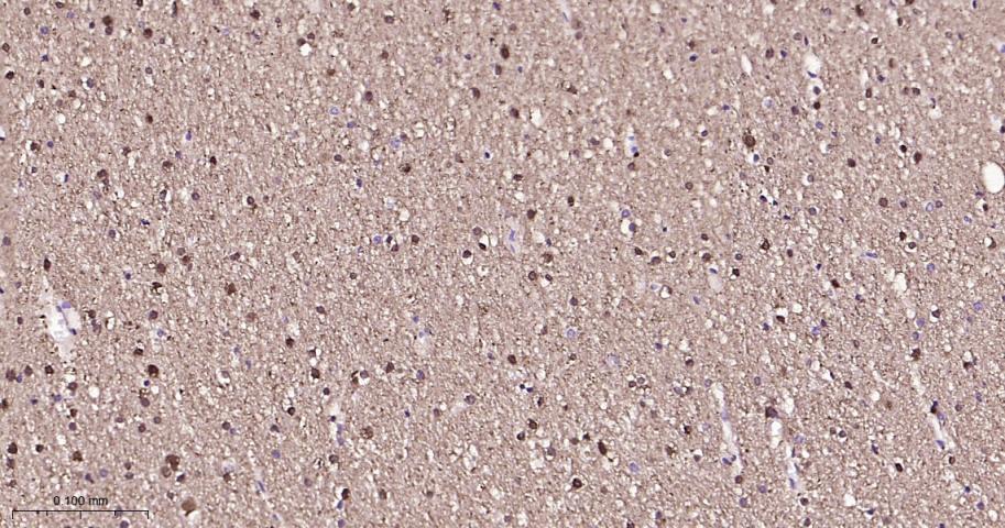 白血病相关蛋白18/癌蛋白18重组兔单抗