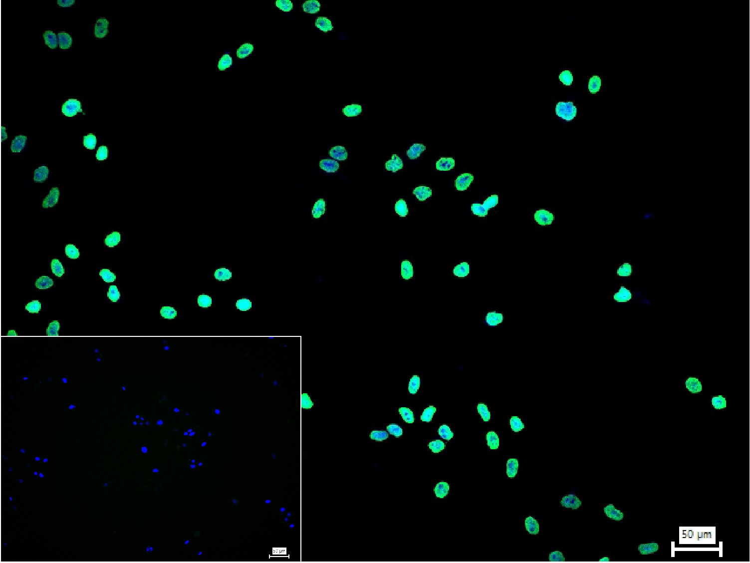 乙酰基赖氨酸/乙酰化赖氨酸抗体-bsm-33202M